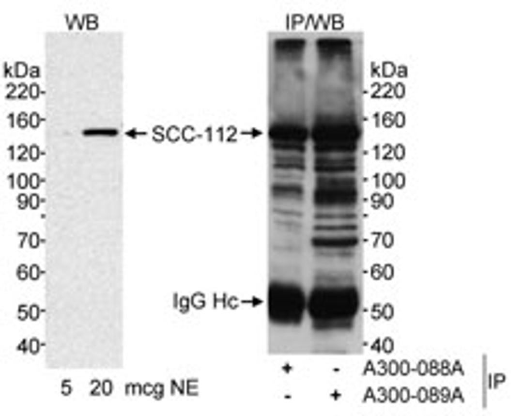 Detection of human SCC-112 by western blot and immunoprecipitation.