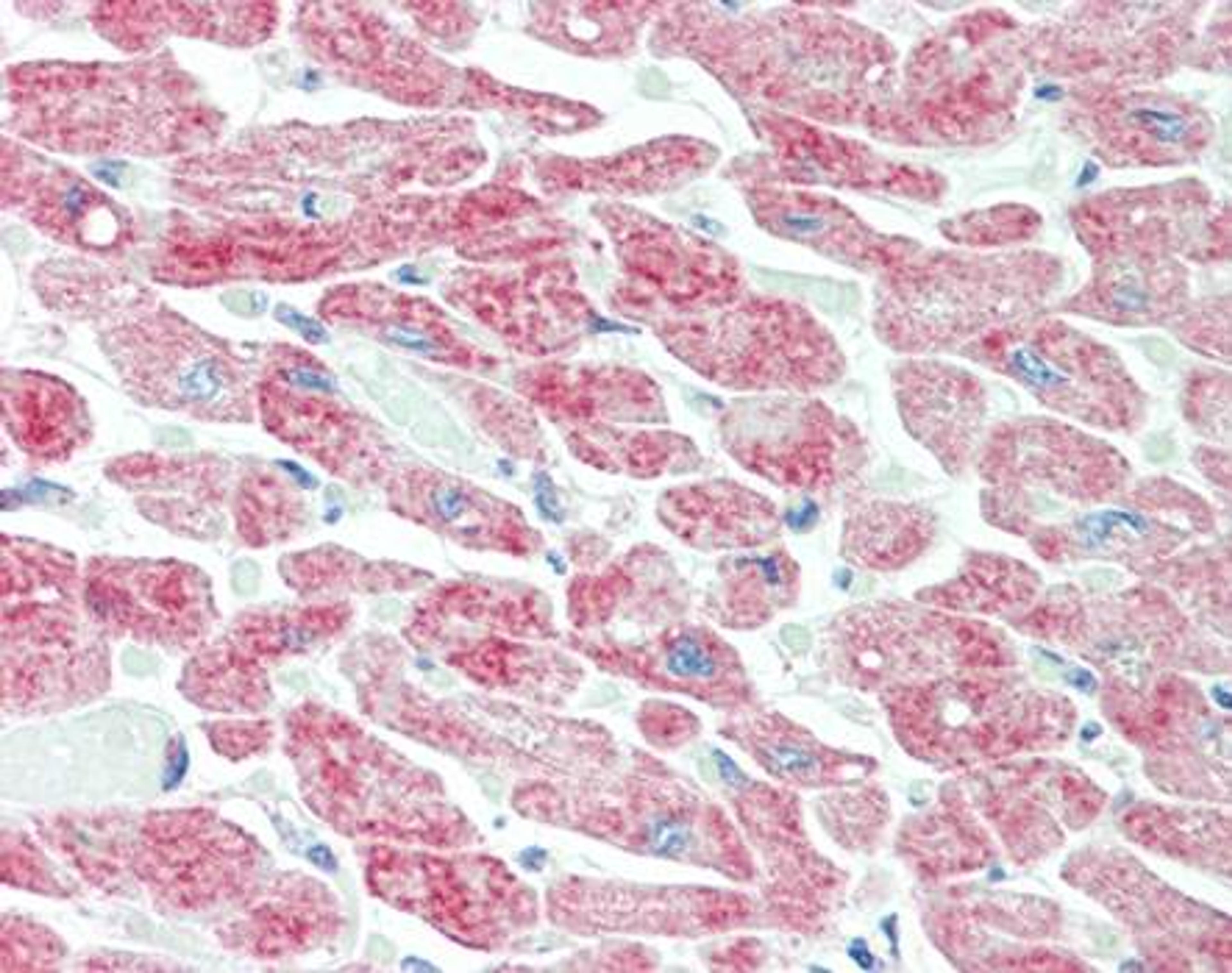 Immunohistochemical staining of paraffin embedded human heart tissue using YTHDF1 antibody (primary antibody at 1:200)