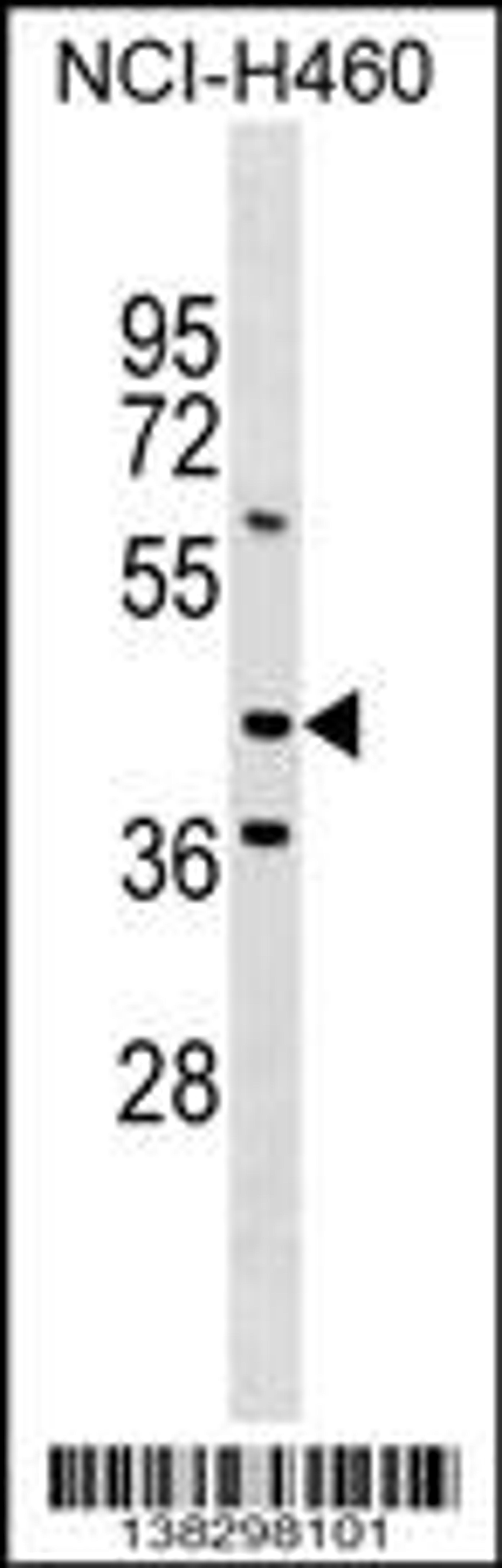 Western blot analysis in NCI-H460 cell line lysates (35ug/lane).