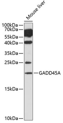 Western blot - GADD45A antibody (A1797)