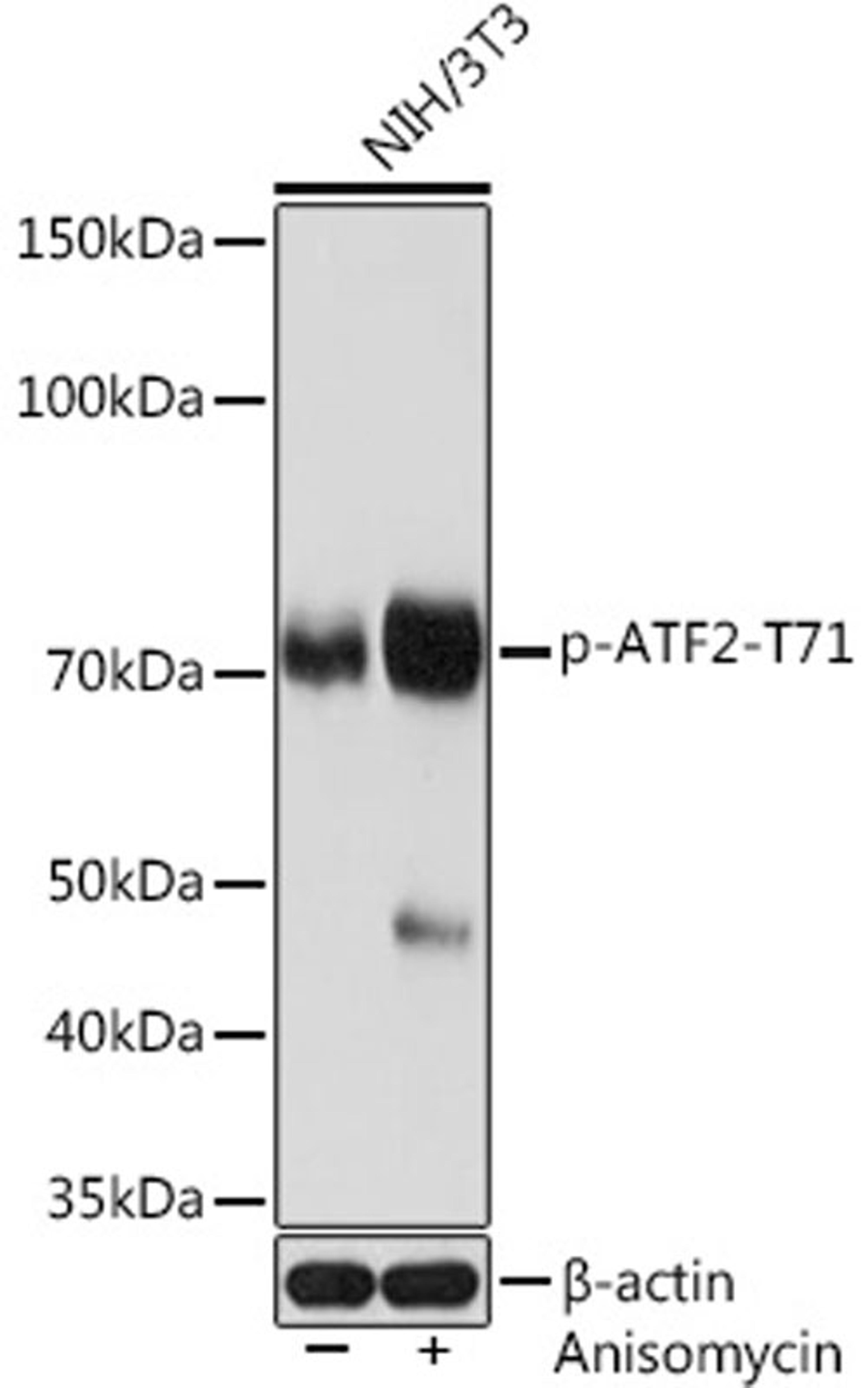 Western blot - Phospho-ATF2-T71 Rabbit mAb (AP1051)