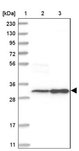 Western Blot: SLC25A22 Antibody [NBP1-84880] - Lane 1: Marker [kDa] 230, 130, 95, 72, 56, 36, 28, 17, 11<br/>Lane 2: Human cell line RT-4<br/>Lane 3: Human cell line U-251MG sp