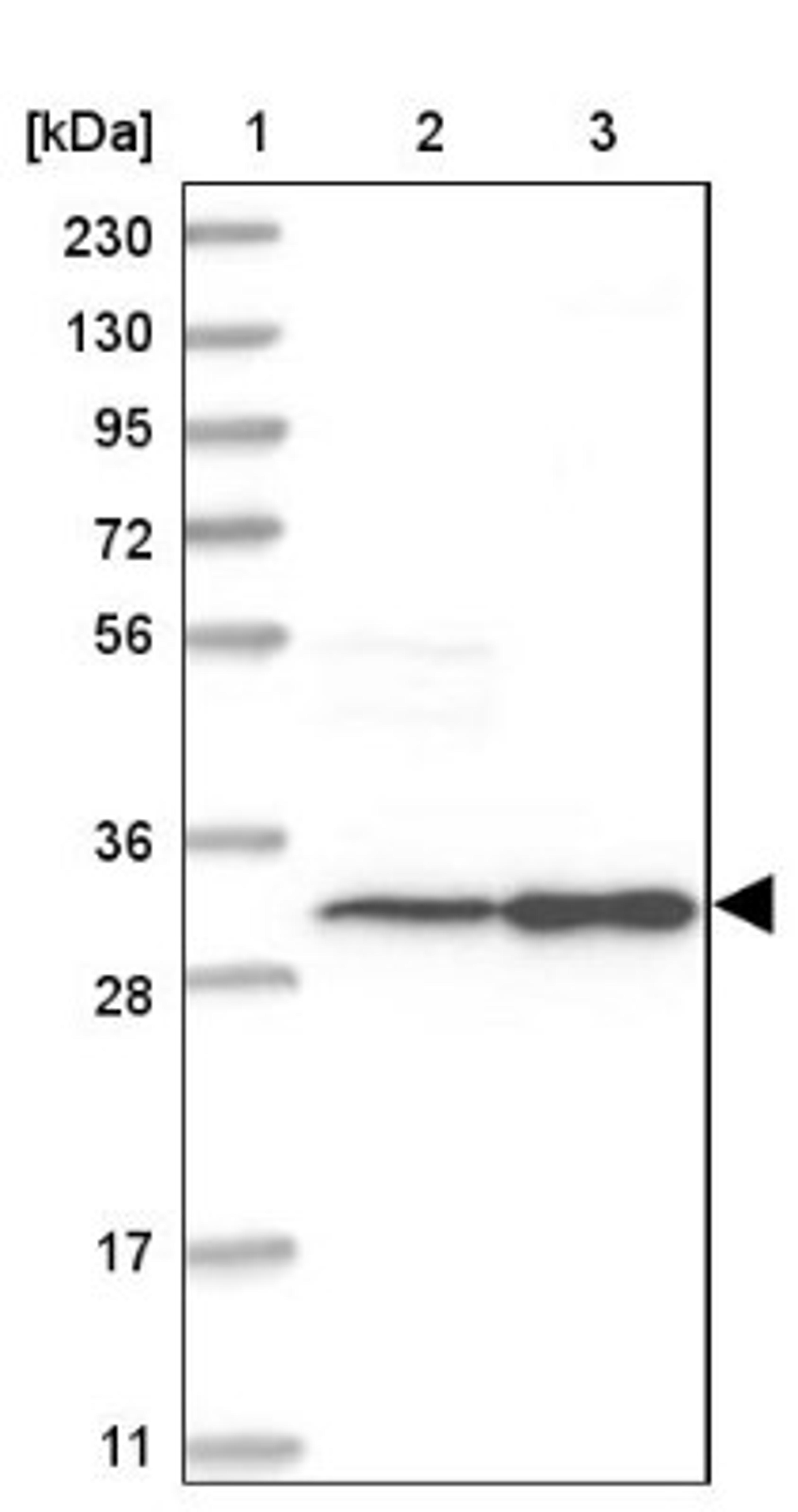 Western Blot: SLC25A22 Antibody [NBP1-84880] - Lane 1: Marker [kDa] 230, 130, 95, 72, 56, 36, 28, 17, 11<br/>Lane 2: Human cell line RT-4<br/>Lane 3: Human cell line U-251MG sp