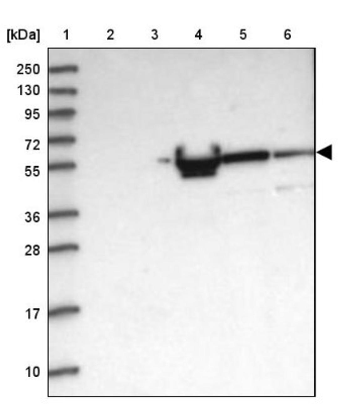 Western Blot: ALKBH8 Antibody [NBP1-81238] - Lane 1: Marker [kDa] 250, 130, 95, 72, 55, 36, 28, 17, 10<br/>Lane 2: Human cell line RT-4<br/>Lane 3: Human cell line U-251MG sp<br/>Lane 4: Human plasma (IgG/HSA depleted)<br/>Lane 5: Human liver tissue<br/>Lane 6: Human tonsil tissue