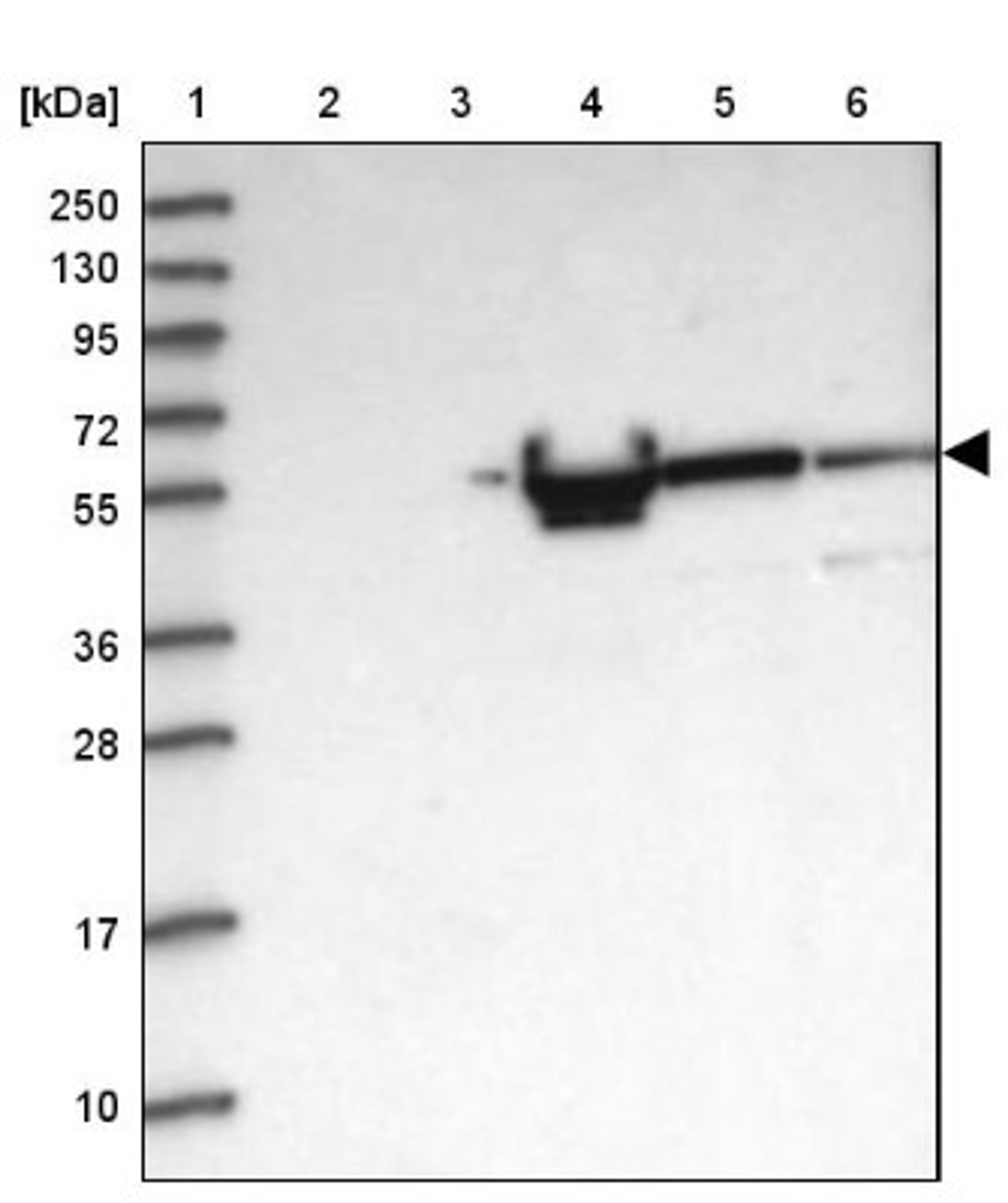 Western Blot: ALKBH8 Antibody [NBP1-81238] - Lane 1: Marker [kDa] 250, 130, 95, 72, 55, 36, 28, 17, 10<br/>Lane 2: Human cell line RT-4<br/>Lane 3: Human cell line U-251MG sp<br/>Lane 4: Human plasma (IgG/HSA depleted)<br/>Lane 5: Human liver tissue<br/>Lane 6: Human tonsil tissue