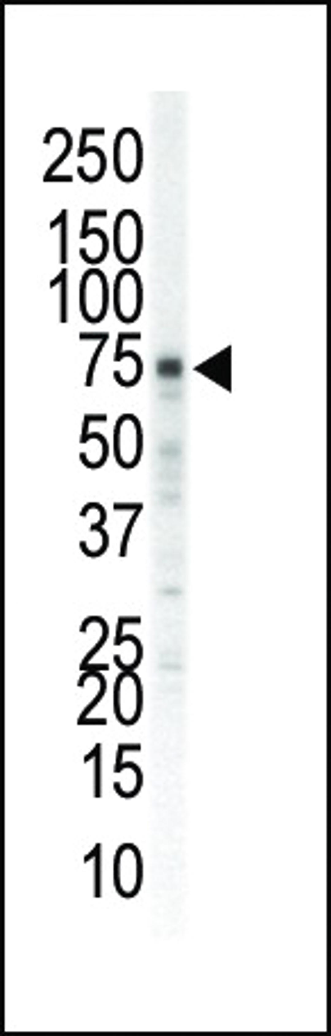 Western blot analysis of anti-EphA5 N-term Pab in mouse brain tissue