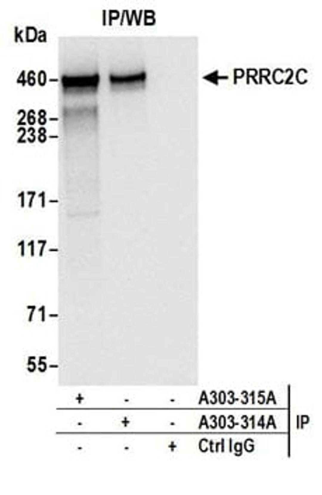 Detection of human PRRC2C by western blot of immunoprecipitates.