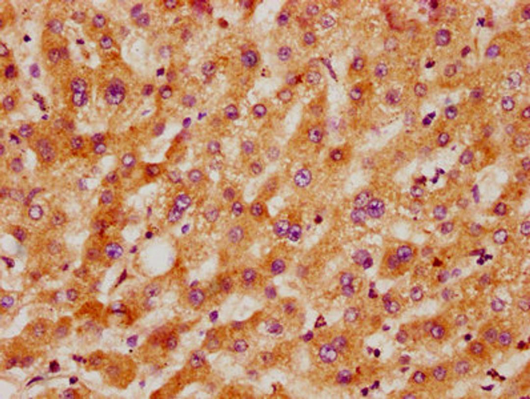 IHC image of CSB-PA5619A0Rb diluted at 1:300 and staining in paraffin-embedded human liver tissue performed on a Leica BondTM system. After dewaxing and hydration, antigen retrieval was mediated by high pressure in a citrate buffer (pH 6.0). Section was blocked with 10% normal goat serum 30min at RT. Then primary antibody (1% BSA) was incubated at 4&deg;C overnight. The primary is detected by a biotinylated secondary antibody and visualized using an HRP conjugated SP system.