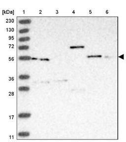 Western Blot: PACSIN1 Antibody [NBP1-87067] - Lane 1: Marker [kDa] 230, 130, 95, 72, 56, 36, 28, 17, 11<br/>Lane 2: Human cell line RT-4<br/>Lane 3: Human cell line U-251MG sp<br/>Lane 4: Human plasma (IgG/HSA depleted)<br/>Lane 5: Human liver tissue<br/>Lane 6: Human tonsil tissue