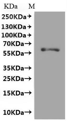 CSB-MP009911RA2(M) is detected by Mouse anti-GFP monoclonal antibody.