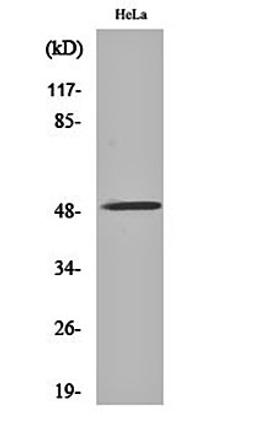 Western blot analysis of Hela cell lysates using AChR alpha10 antibody