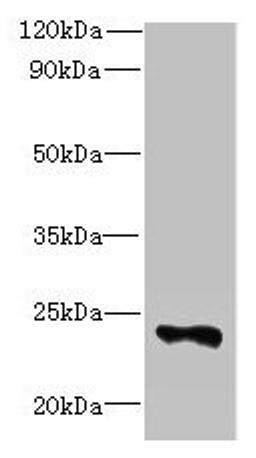 Western blot. All lanes: FAM156A antibody at 5µg/ml + Mouse heart tissue. Secondary. Goat polyclonal to rabbit IgG at 1/10000 dilution. Predicted band size: 25 kDa. Observed band size: 25 kDa