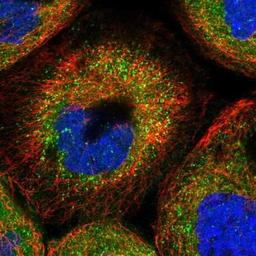 Immunocytochemistry: TMUB2 Antibody [NBP1-81129] - Immunofluorescence:  [NBP1-81129] - Staining of human cell line A-431 shows positivity in cytoplasm & vesicles.