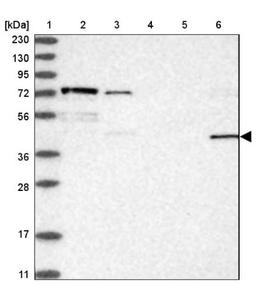 Immunohistochemistry: FAM26E Antibody [NBP1-91162] - Lane 1: Marker [kDa] 230, 130, 95, 72, 56, 36, 28, 17, 11<br/>Lane 2: Human cell line RT-4<br/>Lane 3: Human cell line U-251MG sp<br/>Lane 4: Human plasma (IgG/HSA depleted)<br/>Lane 5: Human liver tissue<br/>Lane 6: Human tonsil tissue