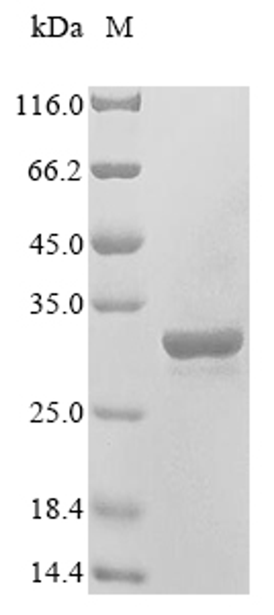 (Tris-Glycine gel) Discontinuous SDS-PAGE (reduced) with 5% enrichment gel and 15% separation gel.