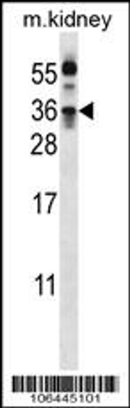 Western blot analysis in mouse kidney tissue lysates (35ug/lane).