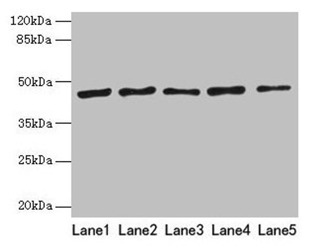 Western blot. All lanes: RRM2 antibody at 8µg/ml. Lane 1: HepG2 whole cell lysate. Lane 2: Jurkat whole cell lysate. Lane 3: Hela whole cell lysate. Lane 4: K562 whole cell lysate. Lane 5: 293T whole cell lysate. Secondary. Goat polyclonal to rabbit IgG at 1/10000 dilution. Predicted band size: 45, 52 kDa. Observed band size: 45 kDa