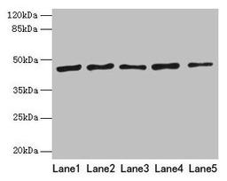 Western blot. All lanes: RRM2 antibody at 8µg/ml. Lane 1: HepG2 whole cell lysate. Lane 2: Jurkat whole cell lysate. Lane 3: Hela whole cell lysate. Lane 4: K562 whole cell lysate. Lane 5: 293T whole cell lysate. Secondary. Goat polyclonal to rabbit IgG at 1/10000 dilution. Predicted band size: 45, 52 kDa. Observed band size: 45 kDa
