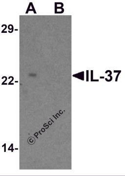 Western blot analysis of IL-37 in human lung tissue lysate with IL-37 antibody at 1 &#956;g/ml in (A) the presence and (B) the absence of blocking peptide.