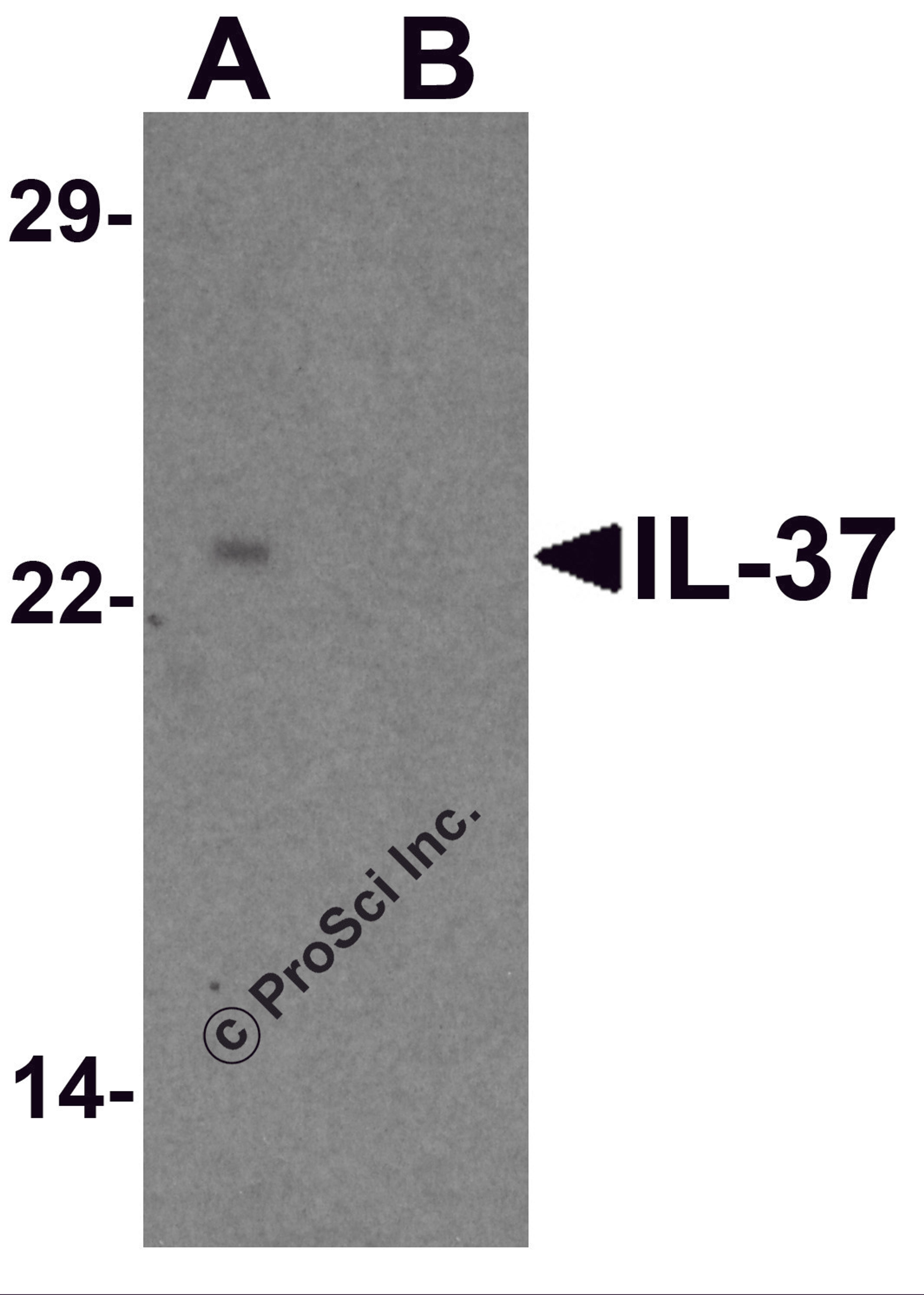 Western blot analysis of IL-37 in human lung tissue lysate with IL-37 antibody at 1 μg/ml in (A) the presence and (B) the absence of blocking peptide.