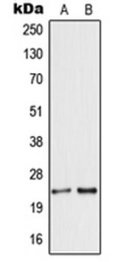 Western blot analysis of HEK293T (Lane 1), MCF7 (Lane 2) whole cell lysates using SCG5 antibody