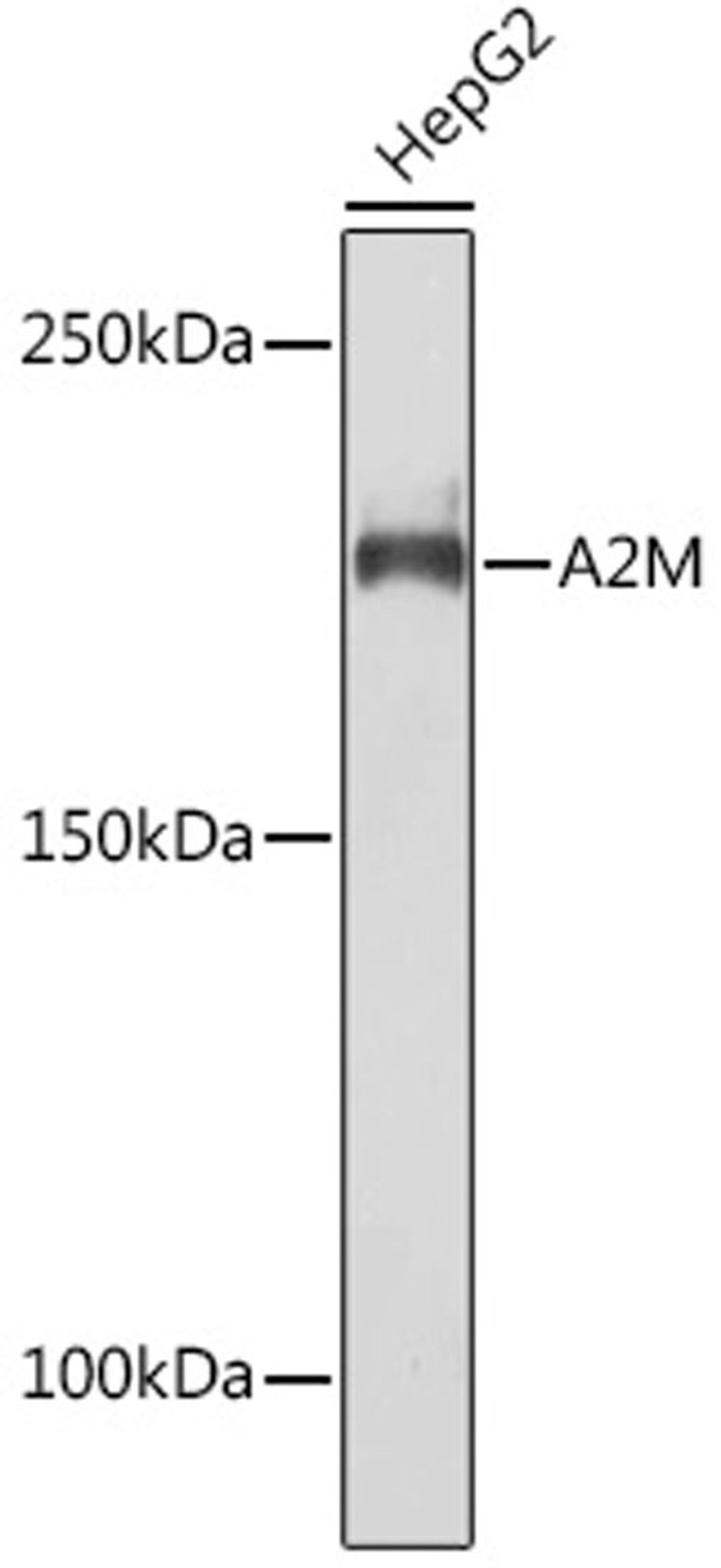 Western blot - A2M Rabbit mAb (A9752)