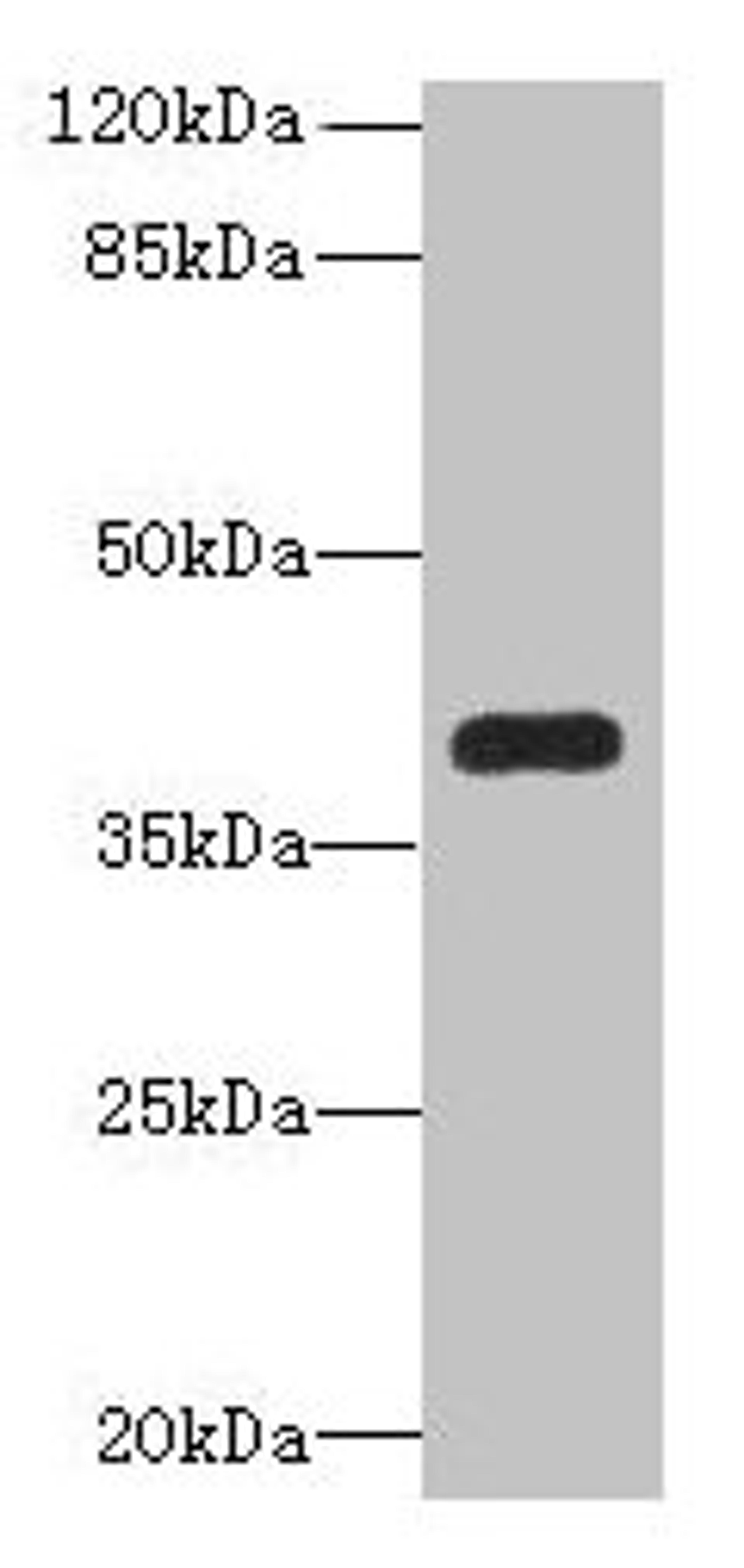 Western blot. All lanes: PNMA1 antibody at 4µg/ml + Mouse brain tissue. Secondary. Goat polyclonal to rabbit IgG at 1/10000 dilution. Predicted band size: 40 kDa. Observed band size: 40 kDa