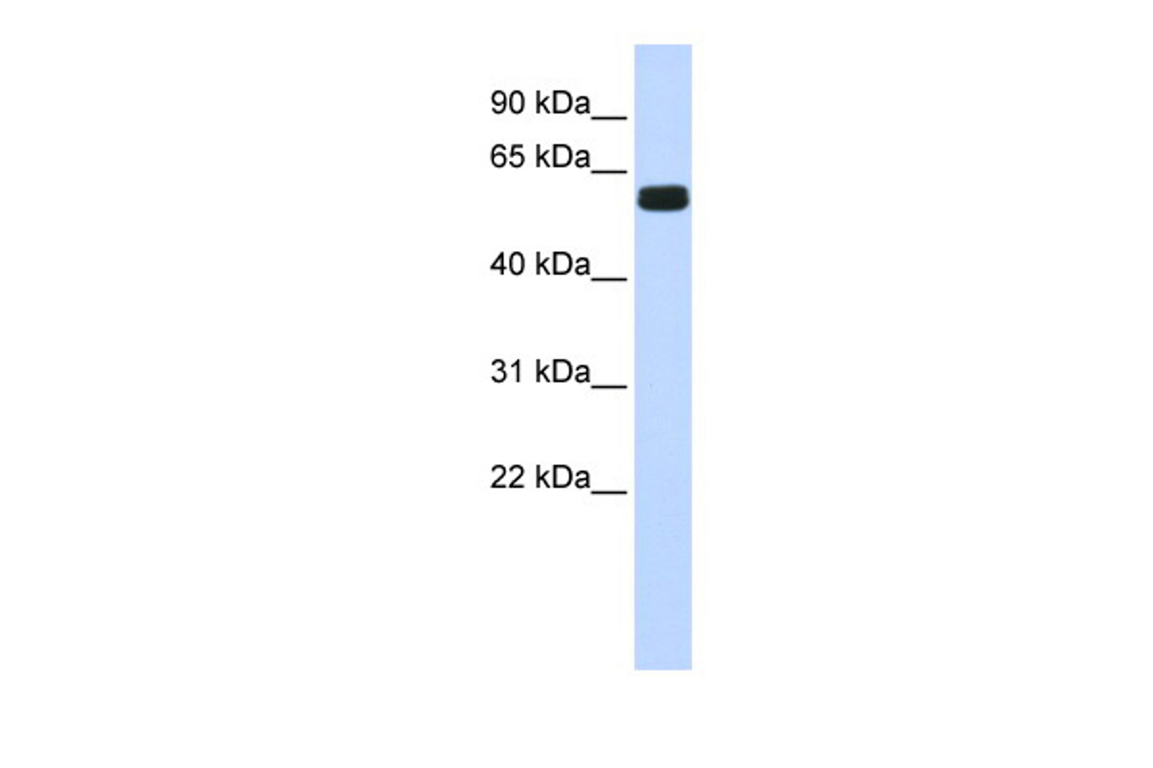 Antibody used in WB on Human Brain at 0.2-1 ug/ml.