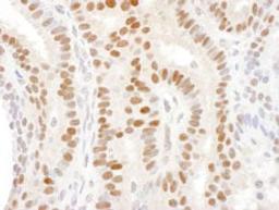 Detection of human DACH1 by immunohistochemistry.