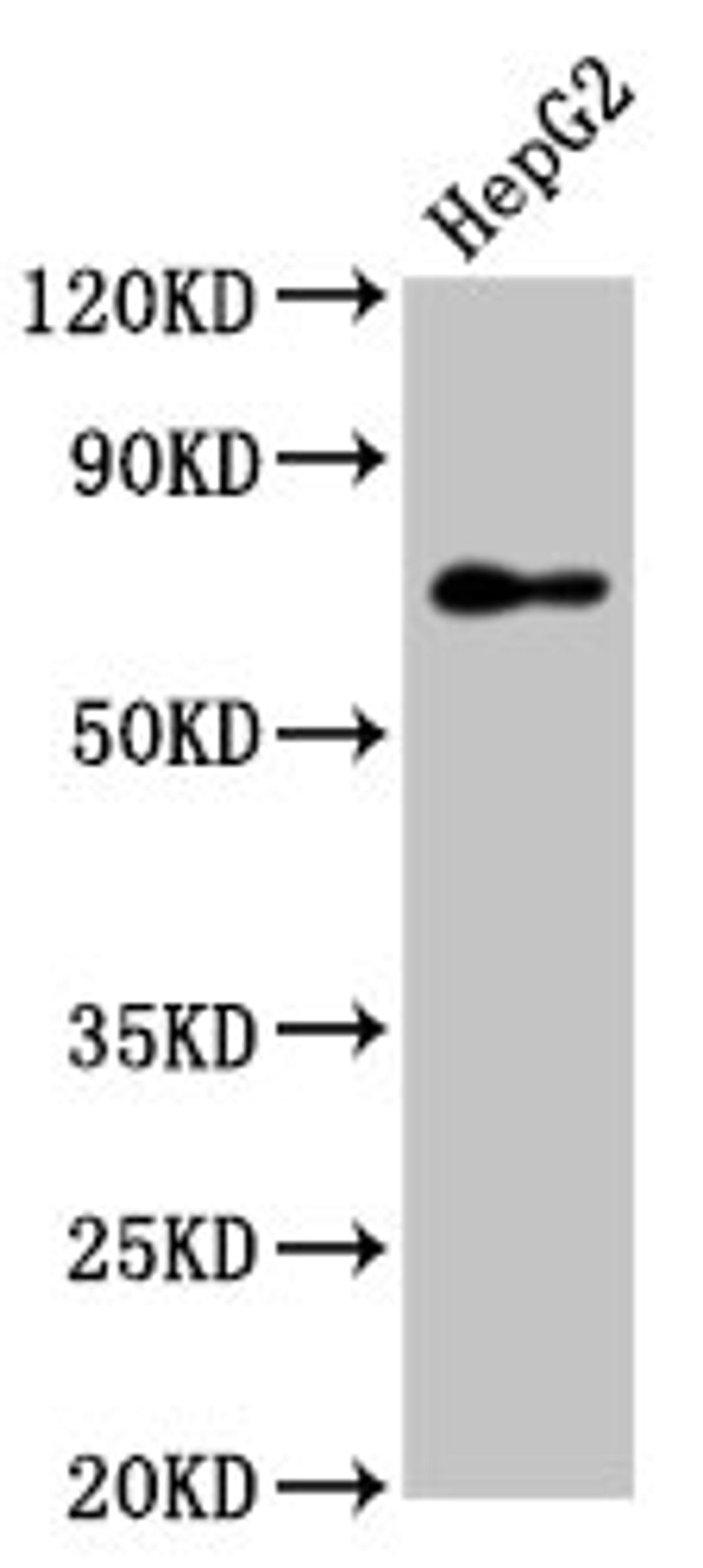 Western Blot. Positive WB detected in: HepG2 whole cell lysate. All lanes: PEX5 antibody at 7.4µg/ml. Secondary. Goat polyclonal to rabbit IgG at 1/50000 dilution. Predicted band size: 71, 67, 70, 73 kDa. Observed band size: 71 kDa