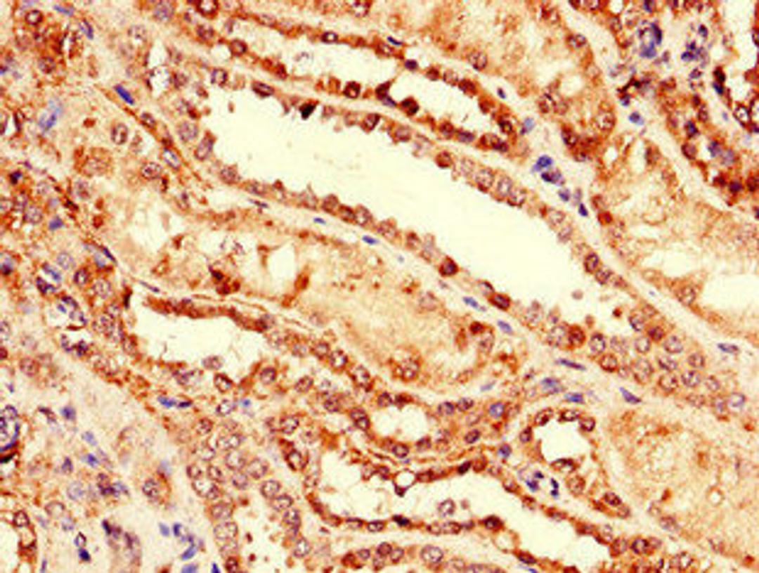 Immunohistochemistry of paraffin-embedded human kidney tissue using CSB-PA10569A0Rb at dilution of 1:100