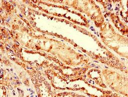 Immunohistochemistry of paraffin-embedded human kidney tissue using CSB-PA10569A0Rb at dilution of 1:100