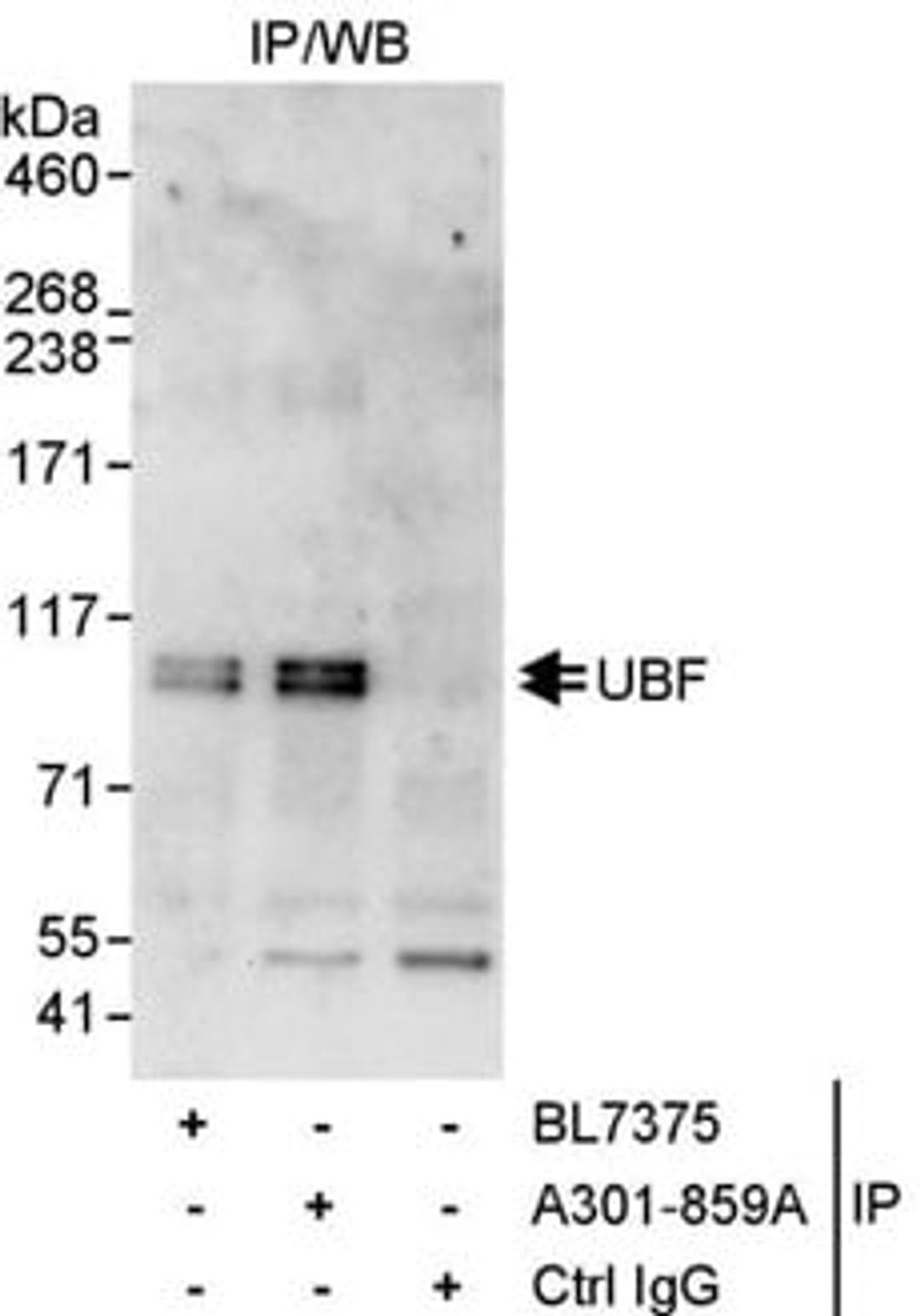 Detection of human UBF by western blot of immunoprecipitates.