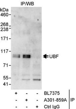 Detection of human UBF by western blot of immunoprecipitates.