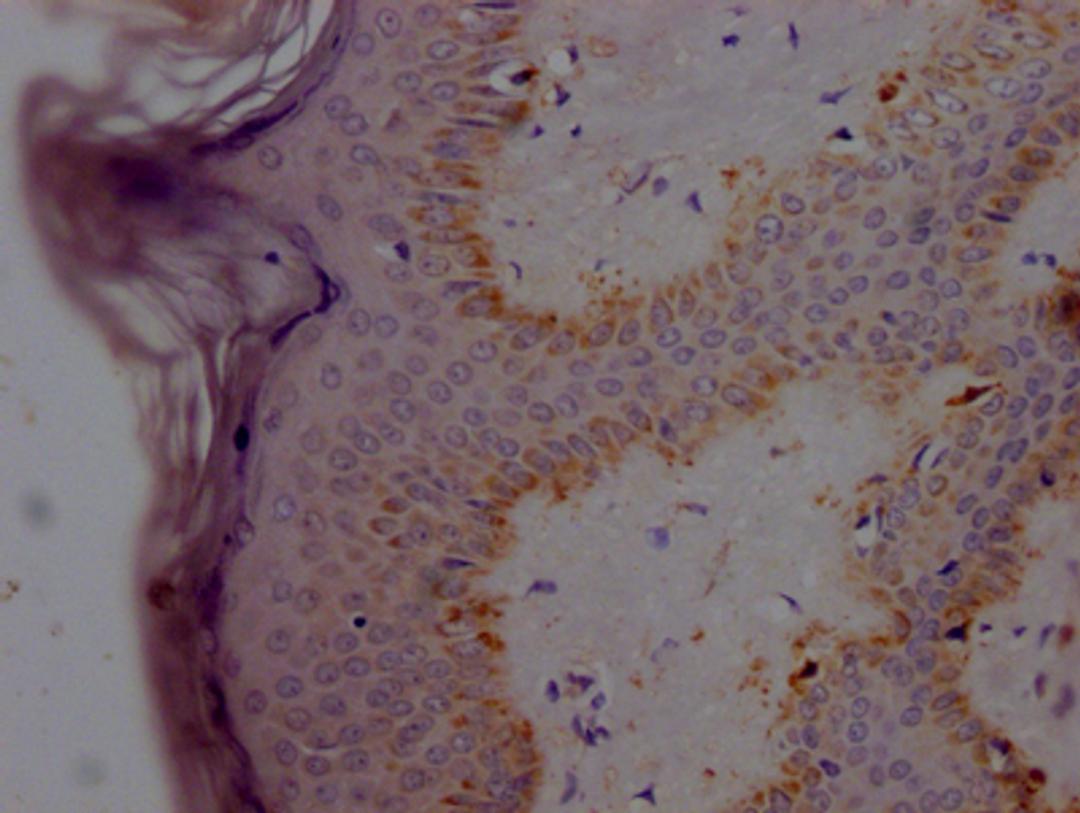 IHC image of CSB-RA585595A0HU diluted at 1:100 and staining in paraffin-embedded human skin tissue performed on a Leica BondTM system. After dewaxing and hydration, antigen retrieval was mediated by high pressure in a citrate buffer (pH 6.0). Section was blocked with 10% normal goat serum 30min at RT. Then primary antibody (1% BSA) was incubated at 4℃ overnight. The primary is detected by a Goat anti-rabbit IgG polymer labeled by HRP and visualized using 0.05% DAB.