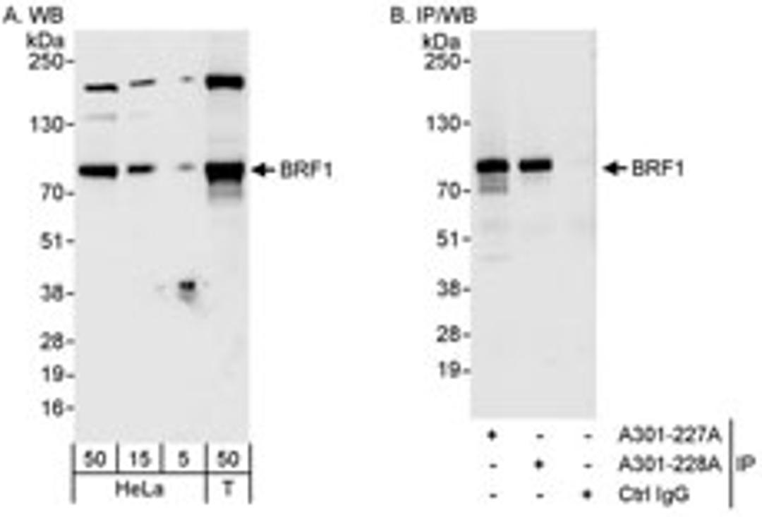 Detection of human BRF1 by western blot and immunoprecipitation.