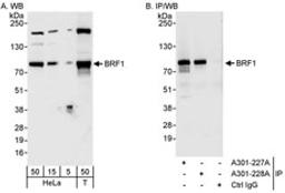 Detection of human BRF1 by western blot and immunoprecipitation.