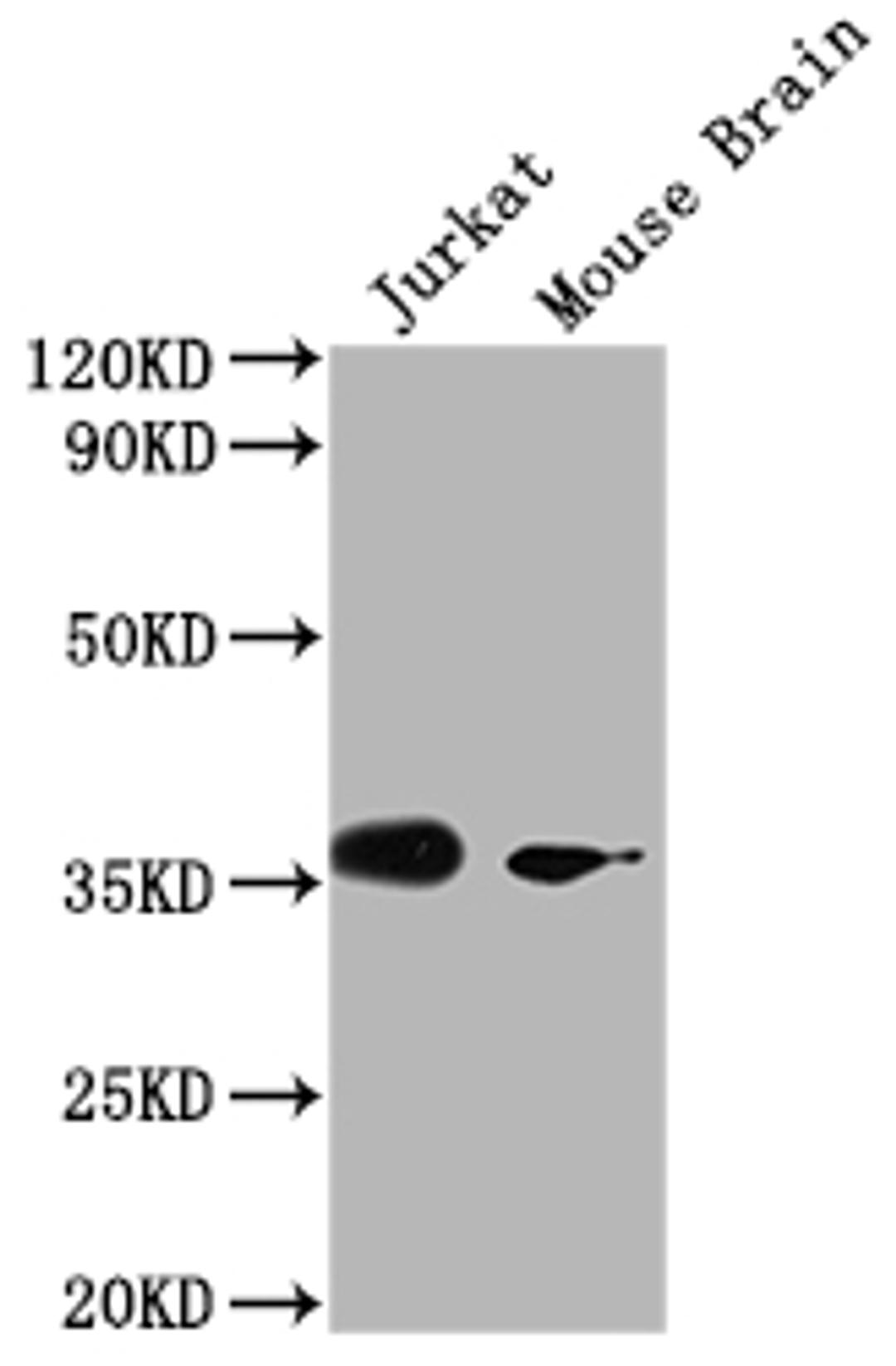 Western Blot. Positive WB detected in: Jurkat whole cell lysate, Mouse Brain tissue. All lanes: OR51F2 antibody at 1:2000. Secondary. Goat polyclonal to rabbit IgG at 1/50000 dilution. Predicted band size: 39 kDa. Observed band size: 39 kDa.
