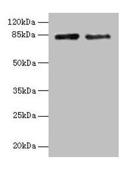 Western blot. All lanes: HJURP antibody at 12µg/ml. Lane 1: Jurkat whole cell lysate. Lane 2: Hela whole cell lysate. Secondary. Goat polyclonal to rabbit IgG at 1/10000 dilution. Predicted band size: 84, 78, 75 kDa. Observed band size: 84 kDa