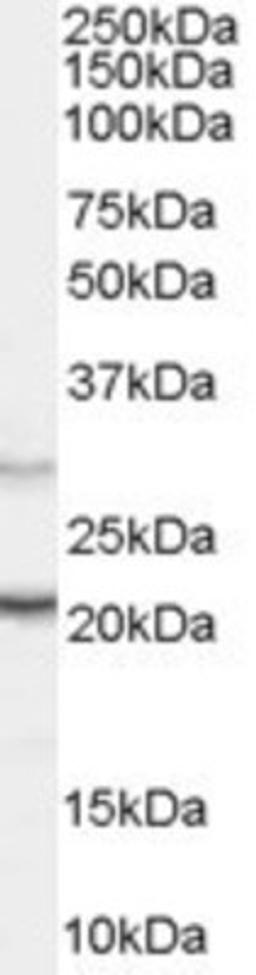 Western Blot: PRL-3 Antibody [NB100-877] - (0.03ug/ml) of Human Pancreas lysate (RIPA buffer, 30ug total protein per lane). Primary incubated for 1 hour. Detected by western blot using chemiluminescence.