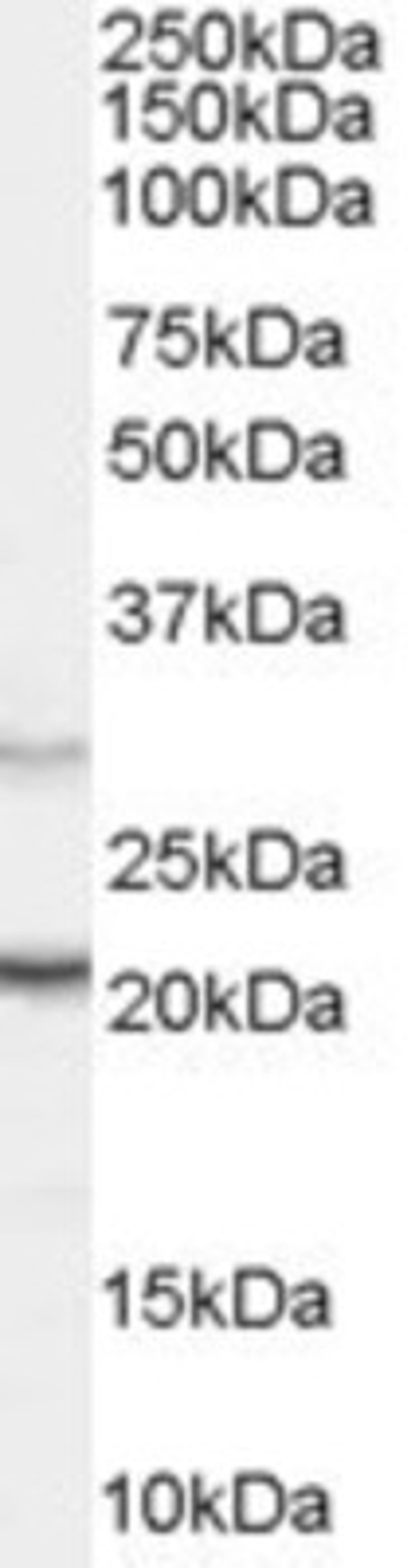 Western Blot: PRL-3 Antibody [NB100-877] - (0.03ug/ml) of Human Pancreas lysate (RIPA buffer, 30ug total protein per lane). Primary incubated for 1 hour. Detected by western blot using chemiluminescence.