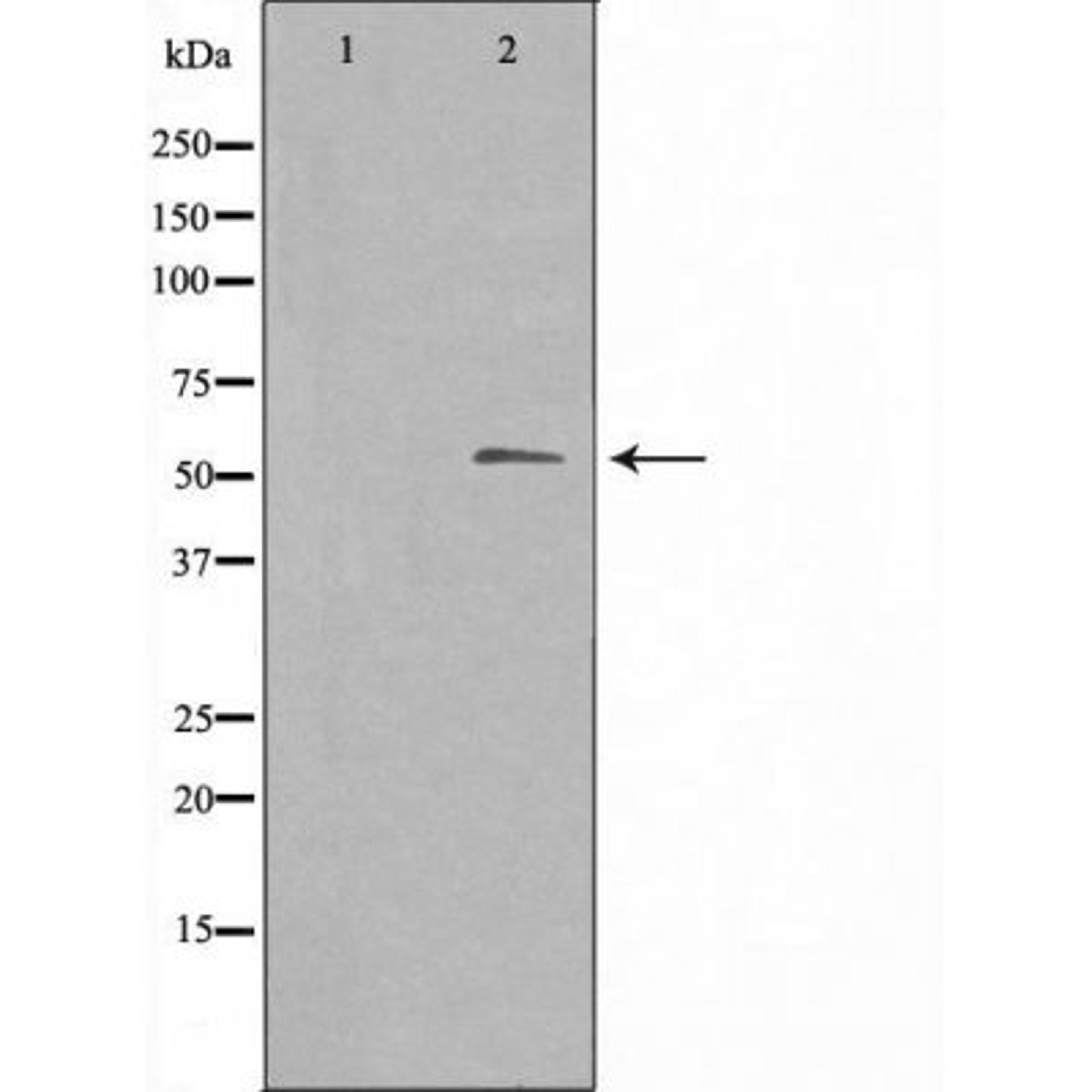 Western blot analysis of Jurkat cells using 3A4/5 (Cytochrome P450) antibody