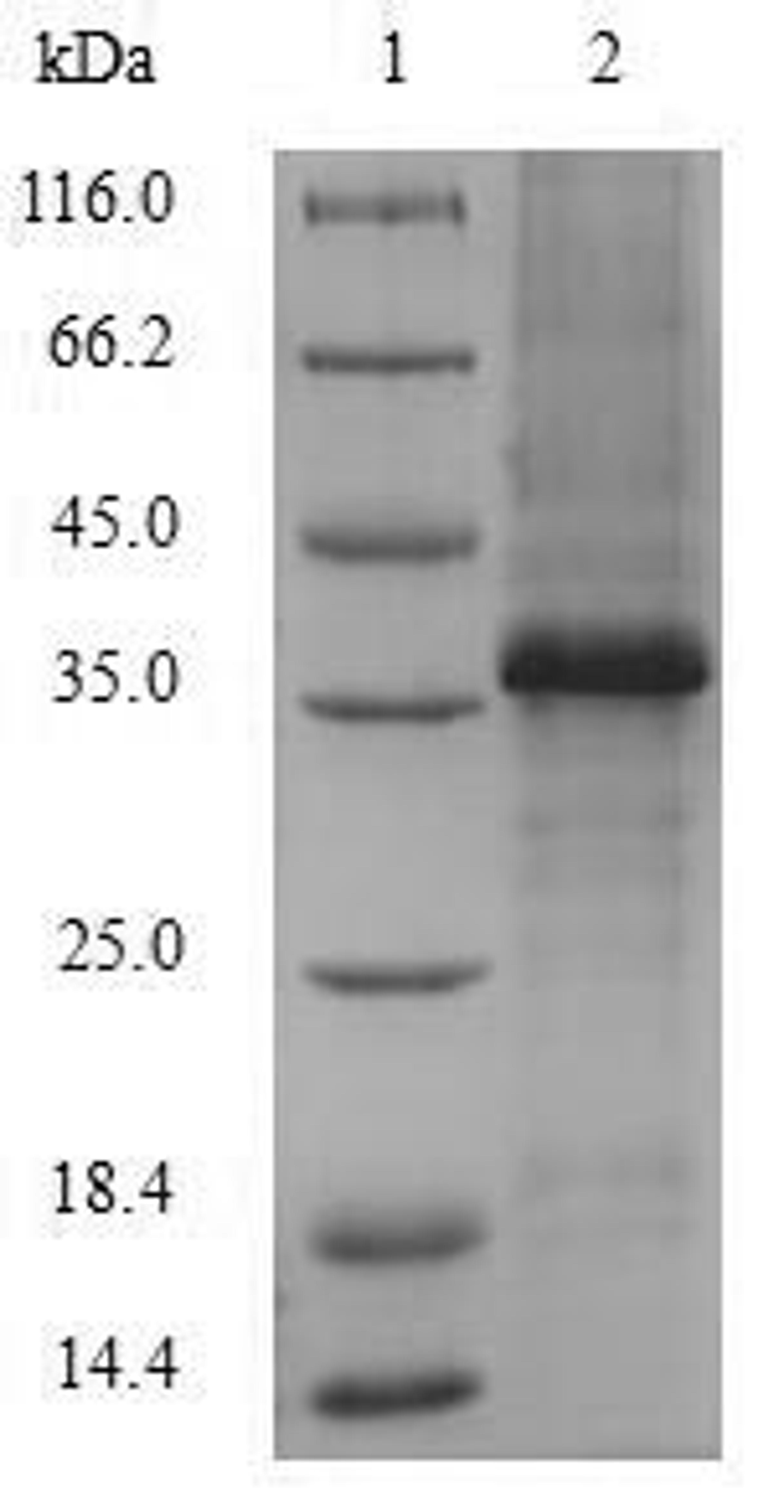 (Tris-Glycine gel) Discontinuous SDS-PAGE (reduced) with 5% enrichment gel and 15% separation gel.