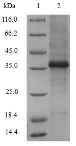(Tris-Glycine gel) Discontinuous SDS-PAGE (reduced) with 5% enrichment gel and 15% separation gel.
