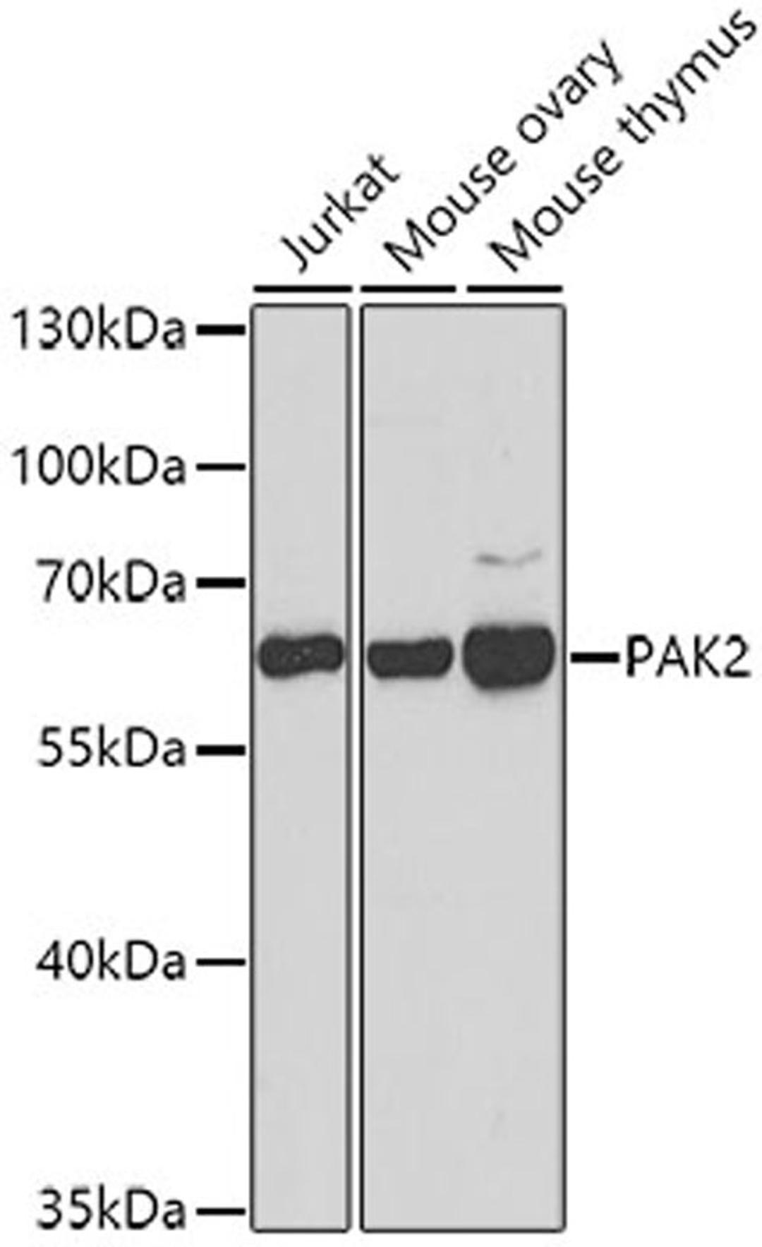 Western blot - PAK2 antibody (A7333)