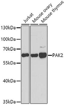 Western blot - PAK2 antibody (A7333)