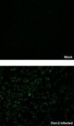 Immunocytochemistry/Immunofluorescence: NS3 Antibody [NBP2-42893] - Analysis of paraformaldehyde-fixed BHK-21 cell, using NS3 (Dengue virus 2) antibody at 1:2000 dilution.