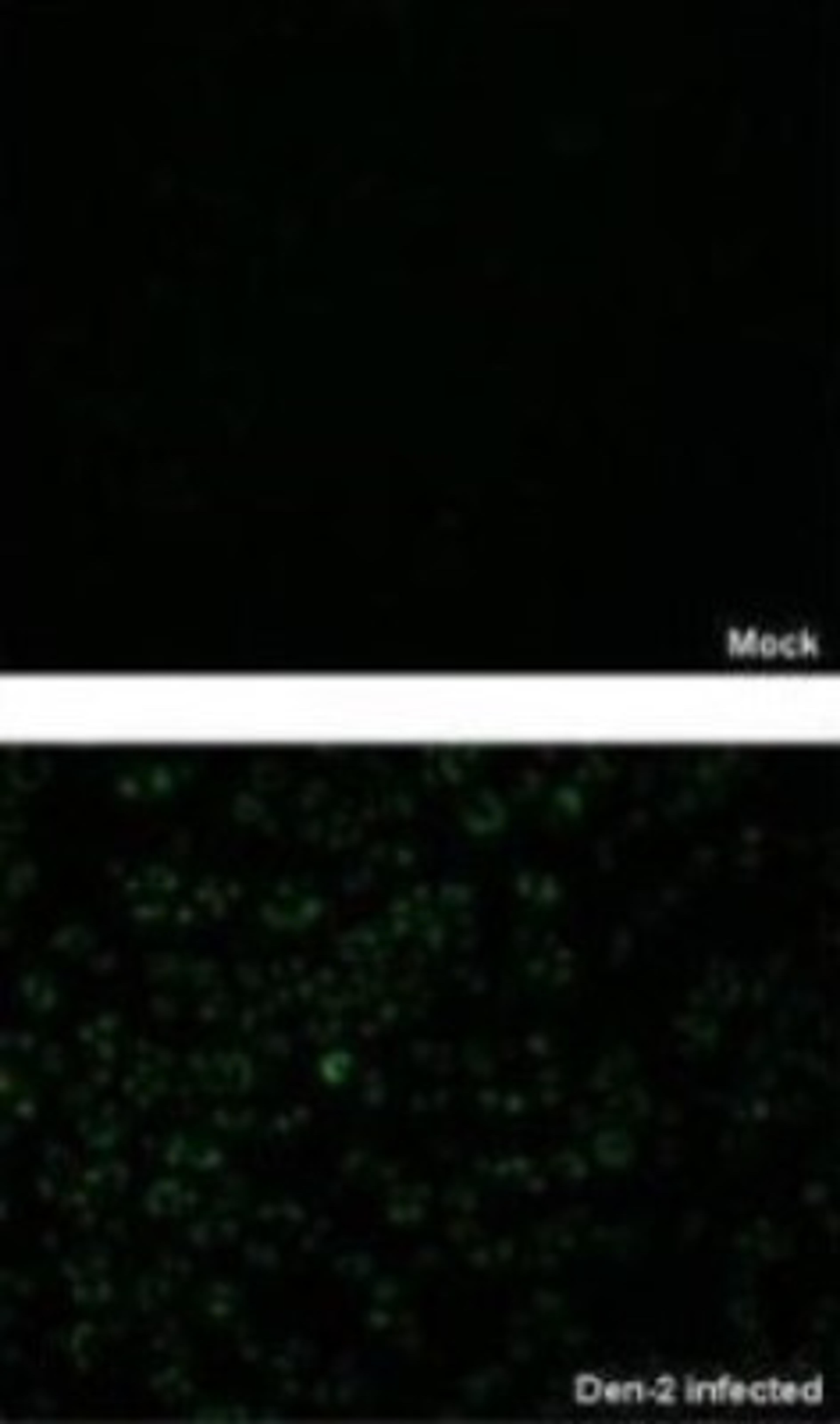 Immunocytochemistry/Immunofluorescence: NS3 Antibody [NBP2-42893] - Analysis of paraformaldehyde-fixed BHK-21 cell, using NS3 (Dengue virus 2) antibody at 1:2000 dilution.