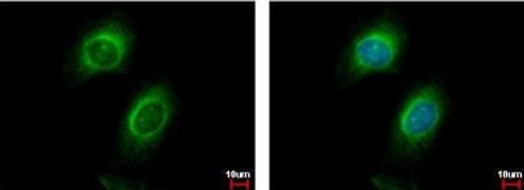 Immunocytochemistry/Immunofluorescence: CD130 Antibody [NBP2-15776] - HeLa cells.