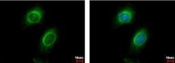 Immunocytochemistry/Immunofluorescence: CD130 Antibody [NBP2-15776] - HeLa cells.